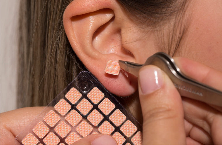 semillas de vaccaria tratamiento de auriculoterapia